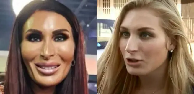 Before After Laura Loomer